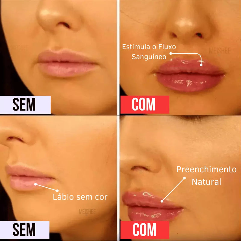 DEROL™ - Cuidado e Preenchimento Labial Natural (PAGUE 1 LEVE 2)