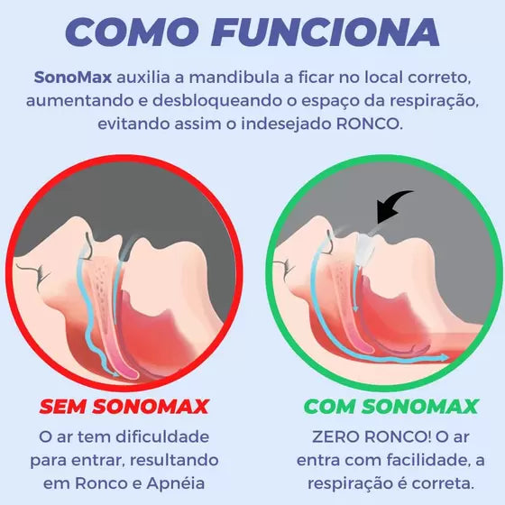 Sonomax - Aparelho Bucal Confortável Antironco Bruxismo e Apnéia